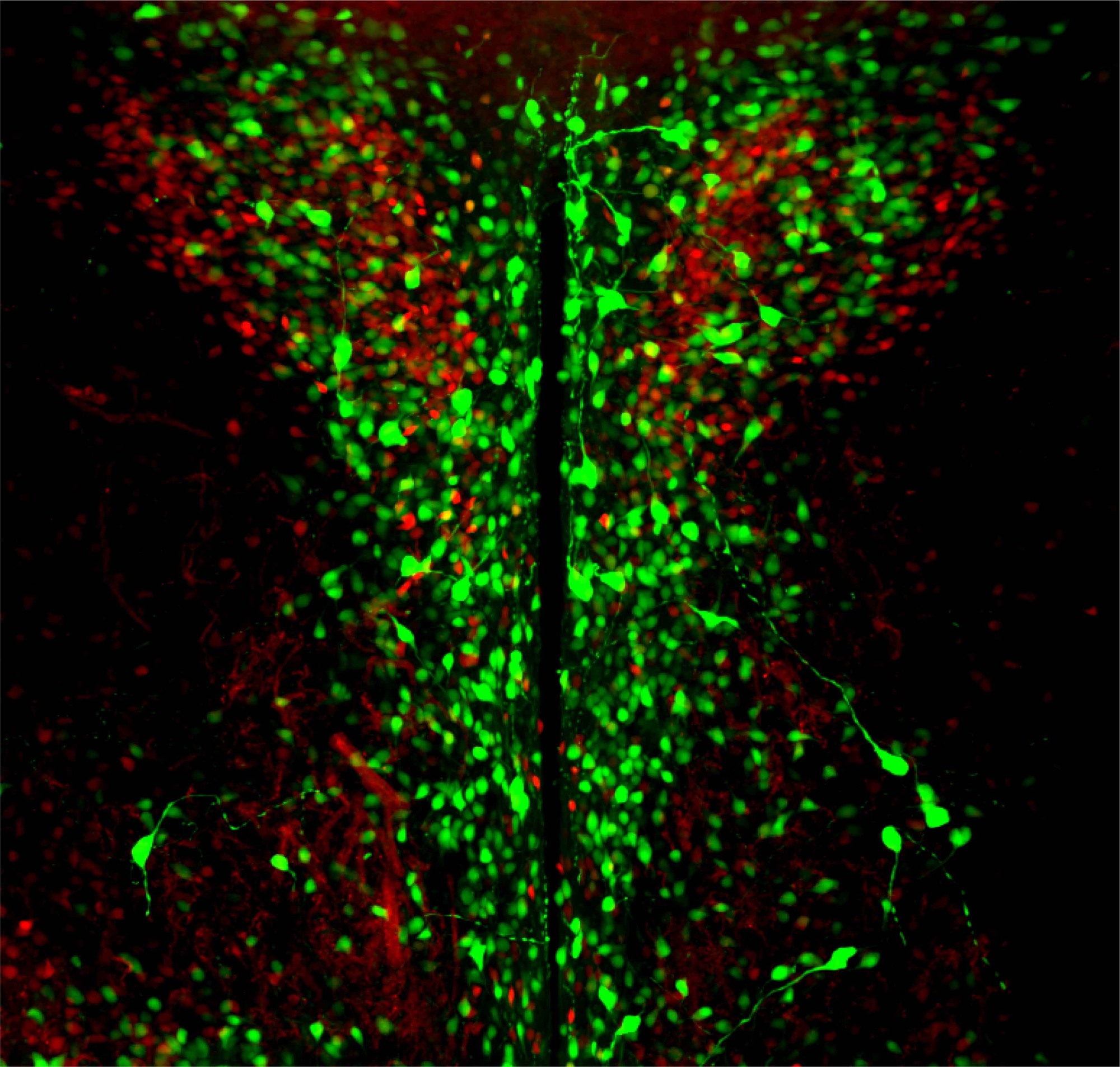 opsin 3 in the PVN