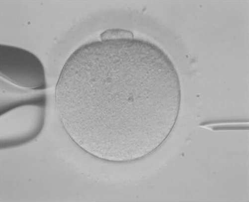 In vitro fertilization