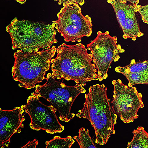 Melanoma cells