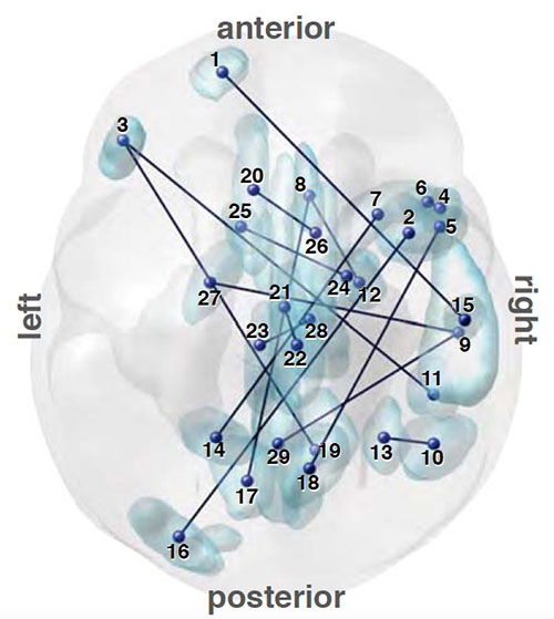 A map of the brain connections