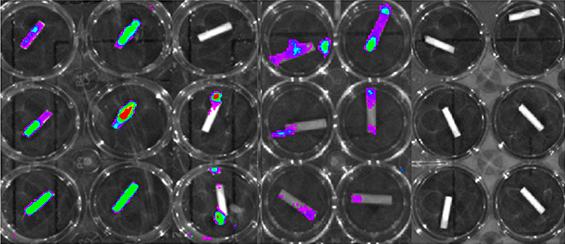 Array of bacteria levels