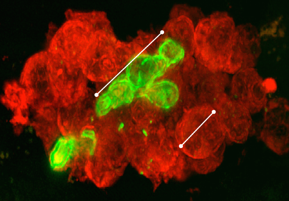 Neutrophils attacking fungal infection in rat tissue