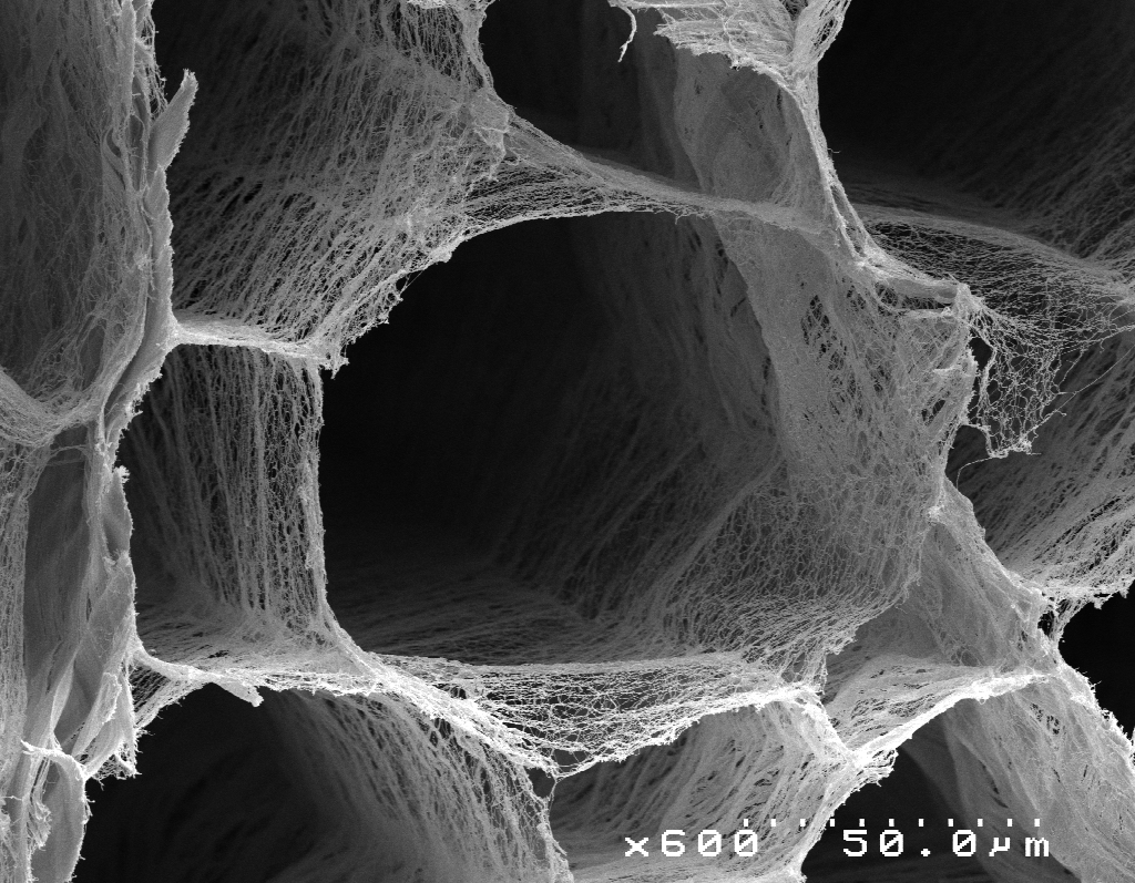 Sleboda connective tissue